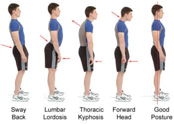 Good posture in comparison to bad posture